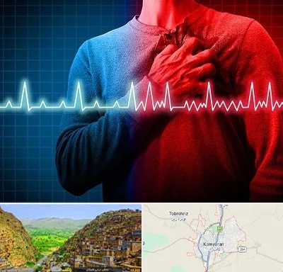 نوار قلب در کامیاران
