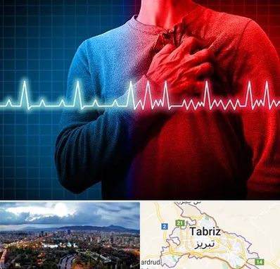نوار قلب در تبریز