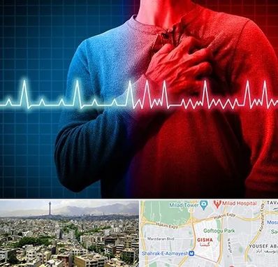 نوار قلب در گیشا 