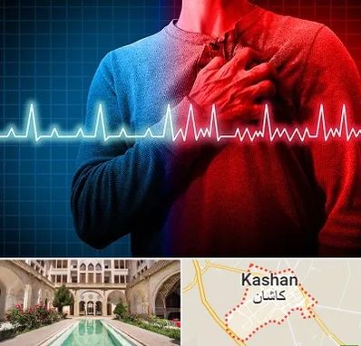 نوار قلب در کاشان