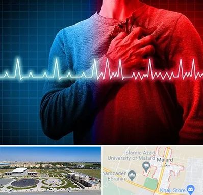 نوار قلب در ملارد