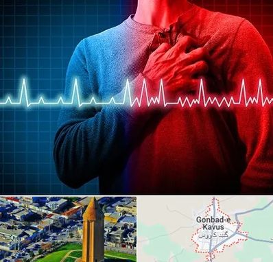 نوار قلب در گنبد کاووس