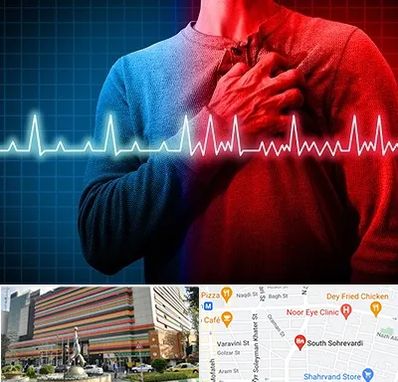 نوار قلب در سهروردی 