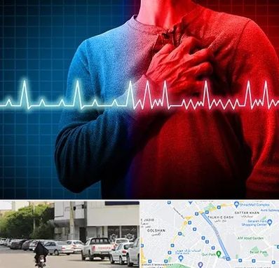 نوار قلب در قدوسی شرقی شیراز