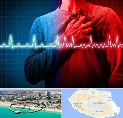 نوار قلب در کیش