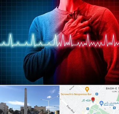 نوار قلب در فلکه گاز شیراز