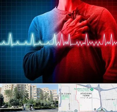 نوار قلب در آپادانا