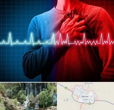 نوار قلب در شیروان