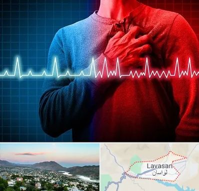 نوار قلب در لواسان