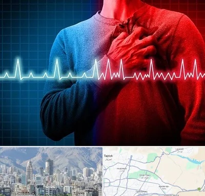 نوار قلب در شمال شرق تهران