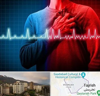 نوار قلب در زعفرانیه 