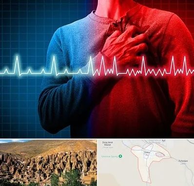 نوار قلب در اسکو