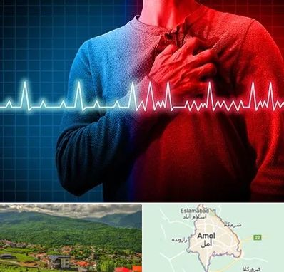 نوار قلب در آمل