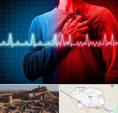 نوار قلب در بم