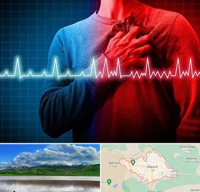 نوار قلب در مرند