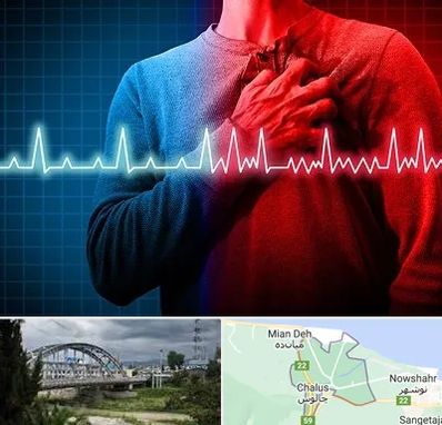 نوار قلب در چالوس