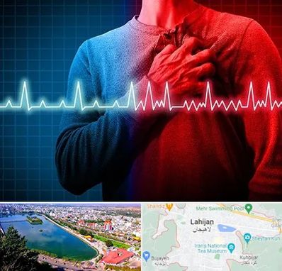 نوار قلب در لاهیجان