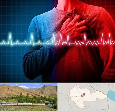 نوار قلب در خاش