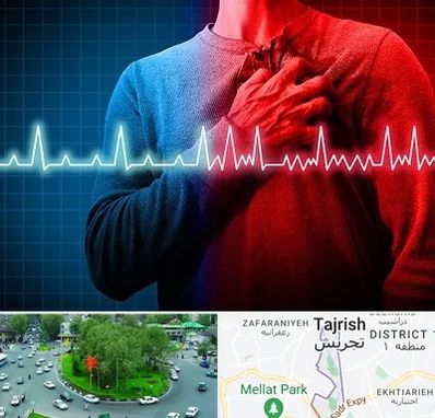 نوار قلب در تجریش 