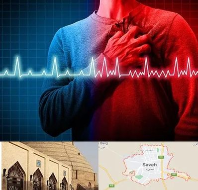 نوار قلب در ساوه