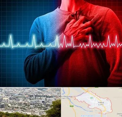 نوار قلب در یاسوج