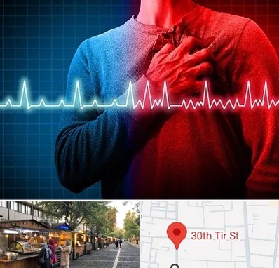 نوار قلب در سی تیر