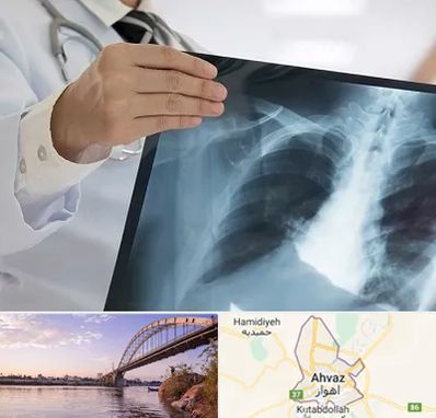 فوق تخصص ریه در اهواز