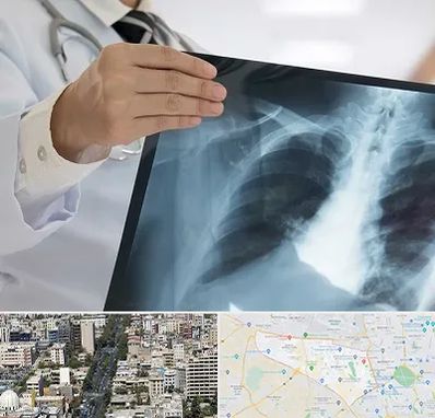 فوق تخصص ریه در منطقه 18 تهران 