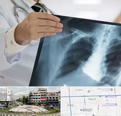 فوق تخصص ریه در مرکز تهران