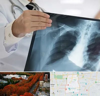 فوق تخصص ریه در منطقه 6 تهران 