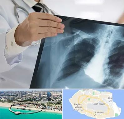 فوق تخصص ریه در کیش