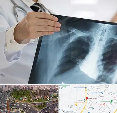 فوق تخصص ریه در سبلان 