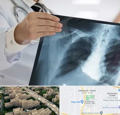 فوق تخصص ریه در اکباتان 