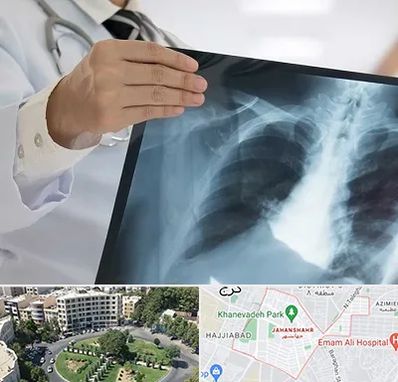 فوق تخصص ریه در جهانشهر کرج 