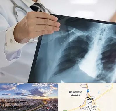 فوق تخصص ریه در قم