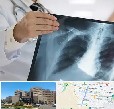 فوق تخصص ریه در صیاد شیرازی مشهد