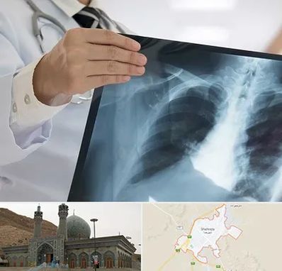 فوق تخصص ریه در شهرضا