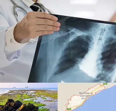 فوق تخصص ریه در بندرلنگه