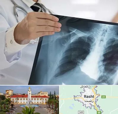 فوق تخصص ریه در رشت