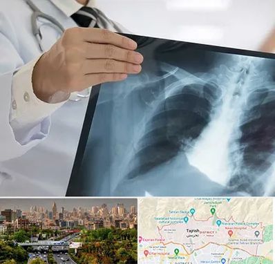فوق تخصص ریه در منطقه 1 تهران 