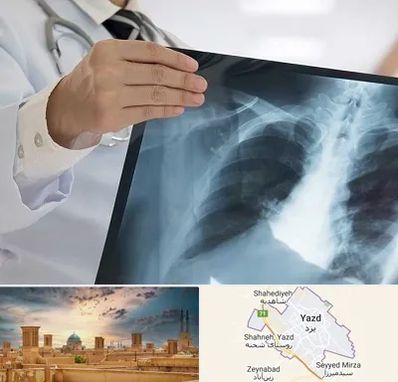 فوق تخصص ریه در یزد