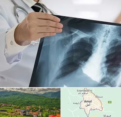 فوق تخصص ریه در آمل