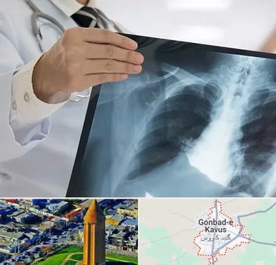 فوق تخصص ریه در گنبد کاووس
