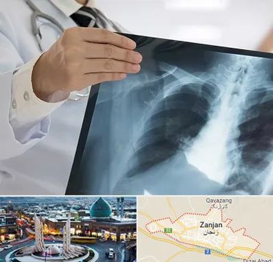 فوق تخصص ریه در زنجان