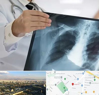 فوق تخصص ریه در هنگام 