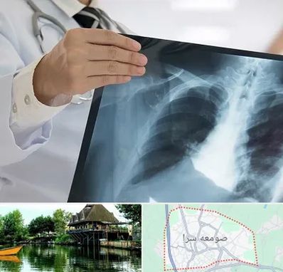فوق تخصص ریه در صومعه سرا