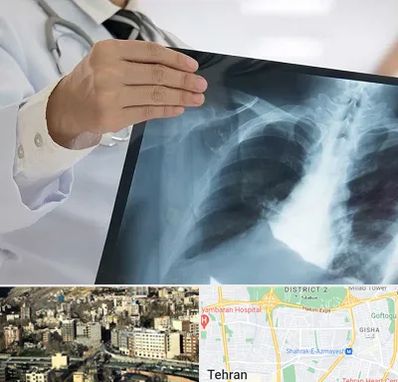 فوق تخصص ریه در مرزداران 