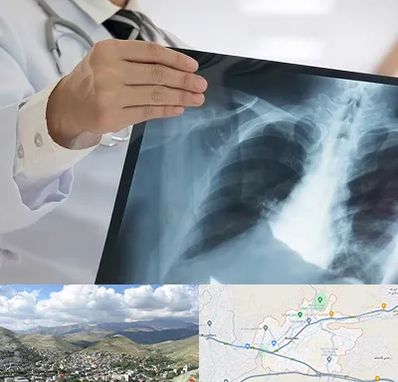 فوق تخصص ریه در رودهن