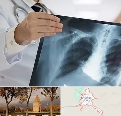 فوق تخصص ریه در تویسرکان