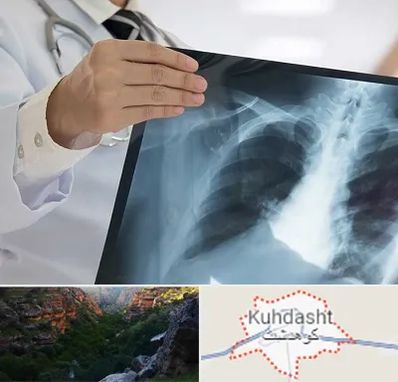 فوق تخصص ریه در کوهدشت